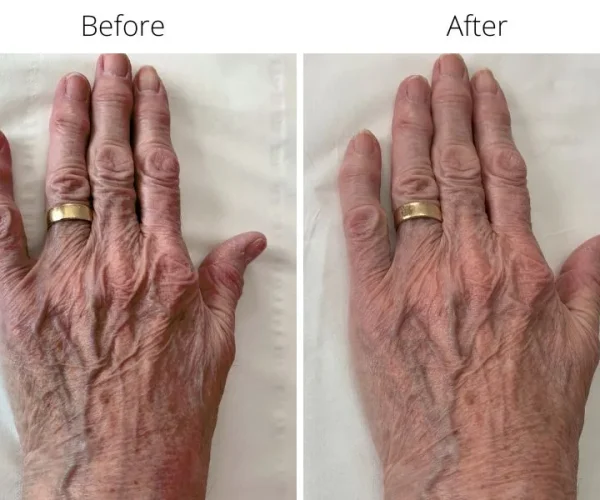 Before-After-031A-Jalupro-web.jpg Before-After-031A-Jalupro-web.jpg