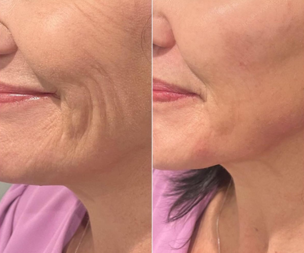 unnamed (6) unnamed (6)